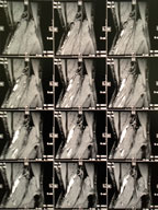 Image set from MRI of knee